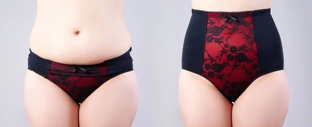 do body shapers work to lose weight